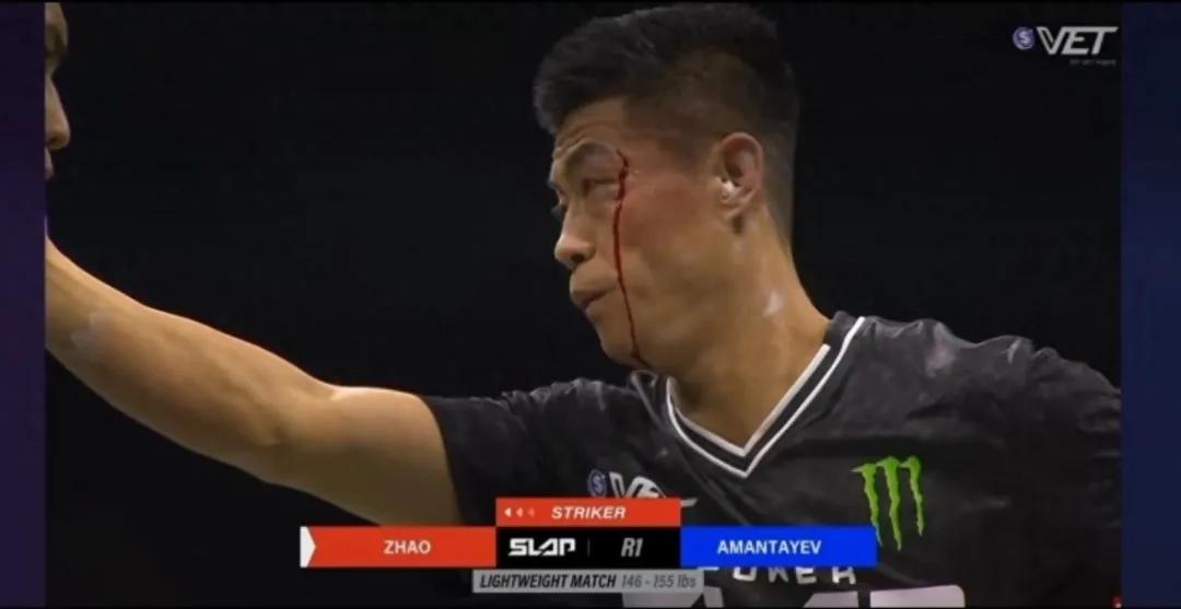 扇耳光大赛选手赵鸿刚：没有想到打成这样，不会为网上言论生气